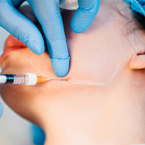 aumento de mentón sin cirugia medicina estética madrid aumento de mentón sin cirugia medicina estética madrid