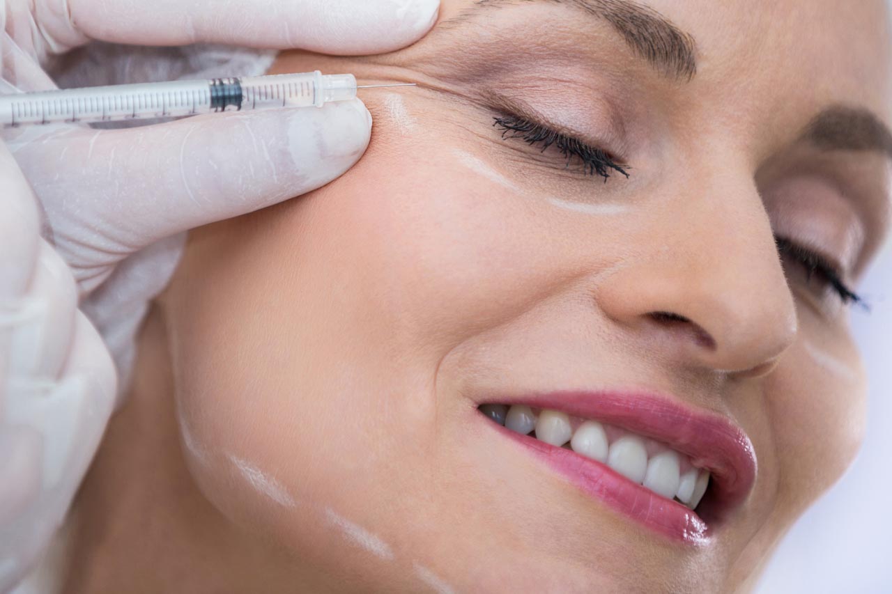 botox antes y después botox madrid